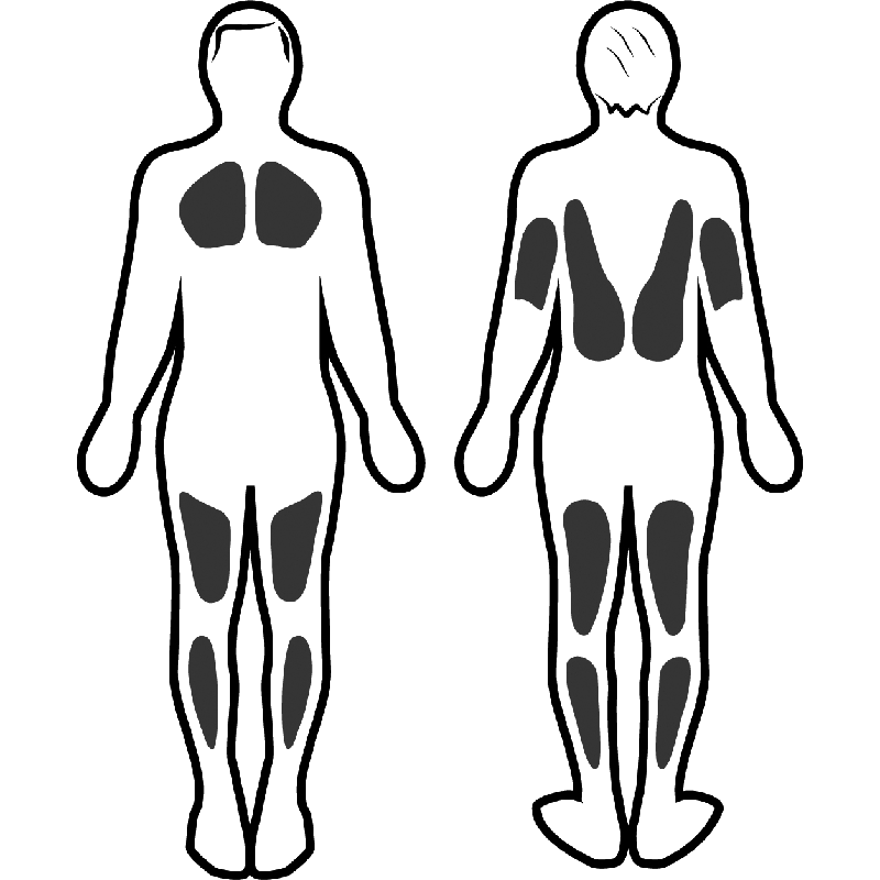 Estimulación muscular