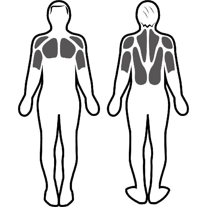 Estimulación muscular