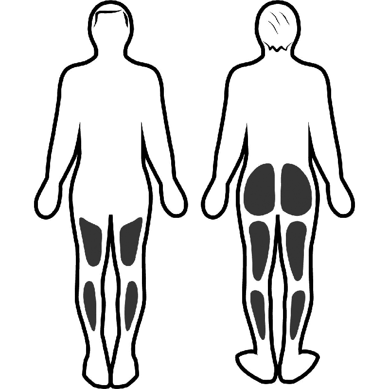 Estimulación muscular