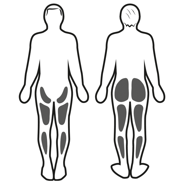 Estimulación muscular