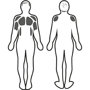 Estimulación muscular