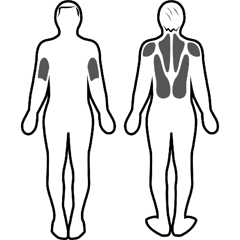 Estimulación muscular