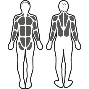 Estimulación muscular